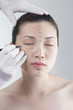 Woman has her face drawn around her eye in preparation for cosmetic surgery