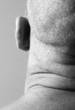 Back shot of a bald man's head