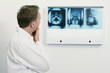 Doctor looking at X-ray images