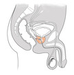 prostate