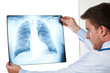 Doctor diagnosis x-ray