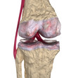 Illustration: Osteoarthritis : Knee joint with ligaments and cartilages Osteoarthritis : Knee joint with ligaments and cartilages