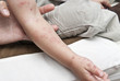 Sintomas del herpes zoster en el brazo de un niño.
