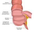 appendix medical vector illustration