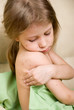 Foto: chickenpox chickenpox