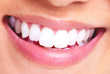 Smile.