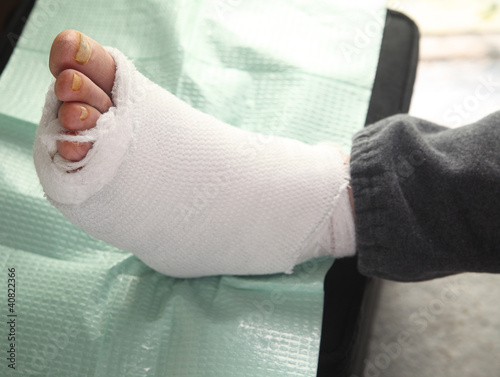 Photo: diabetic foot injury diabetic foot injury