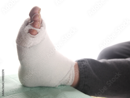Photo: diabetic's infected foot bandaged diabetic's infected foot bandaged