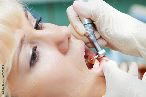 Photo: dentist healthcare teeth polishing work dentist healthcare teeth polishing work