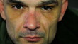 Man's face with injured nose