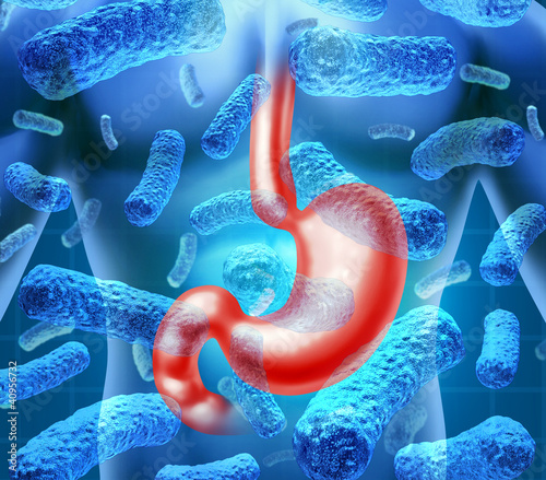 Illustration: Stomach Infection Stomach Infection