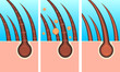 skin hair layer illustration vector