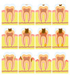 Internal structure of tooth