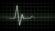 looping EKG display electrocardiogram pulse real waveform