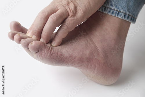 Photo: man with itchy toes man with itchy toes