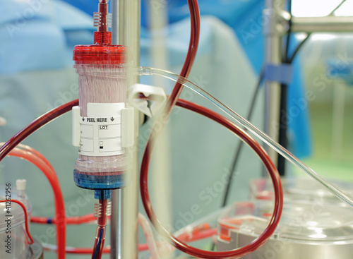 Photo: ultrafiltration during cardiopulmonary bypass. ultrafiltration during cardiopulmonary bypass.