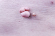 red skin is an elderly man with defects