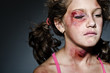 Domestic violence