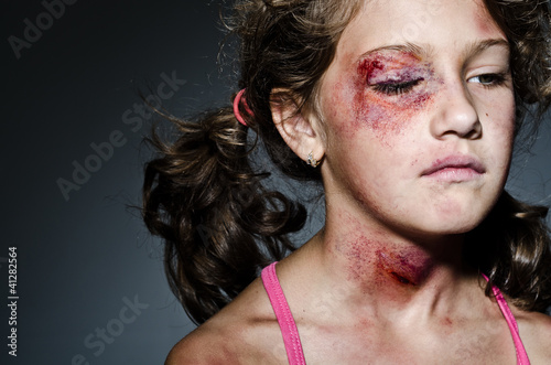Photo: Domestic violence Domestic violence
