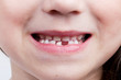 The baby's mouth