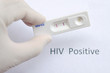 HIV positive