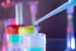 Test tubes closeup on blue background. Test tubes closeup on blue background.
