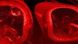 Human blood arteries and veins cut section