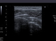 computerized echography