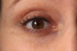 oeil