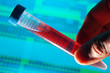 Blood analysis