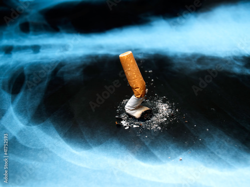 Photo: Smoking issues Smoking issues