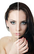 Photo: The beautiful girl with problems on the face The beautiful girl with problems on the face