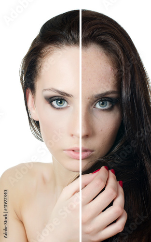 Photo: The beautiful girl with problems on the face The beautiful girl with problems on the face