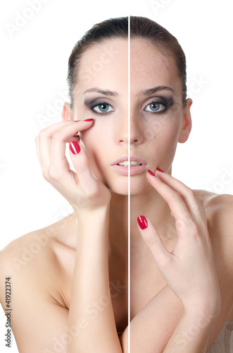 Photo: The beautiful girl with problems on the face The beautiful girl with problems on the face