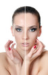Photo: The beautiful girl with problems on the face The beautiful girl with problems on the face