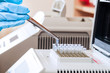Loading DNA samples for PCR