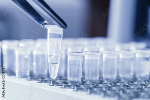 Photo: Loading DNA samples for PCR Loading DNA samples for PCR