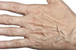 Photo: wrinkled woman skin on hand wrinkled woman skin on hand