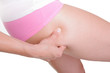 Foto: Cellulite Cellulite