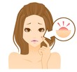 ニキビ　吹き出物　女性