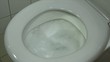 Video: wc spülung wc spülung