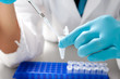 Photo: Drops the biological solution in eppendorf Drops the biological solution in eppendorf