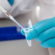 Photo: Drops the biological solution in eppendorf Drops the biological solution in eppendorf