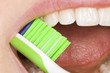 Photo: Mundhygiene Mundhygiene