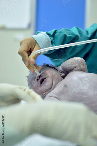 Photo: New born infant New born infant