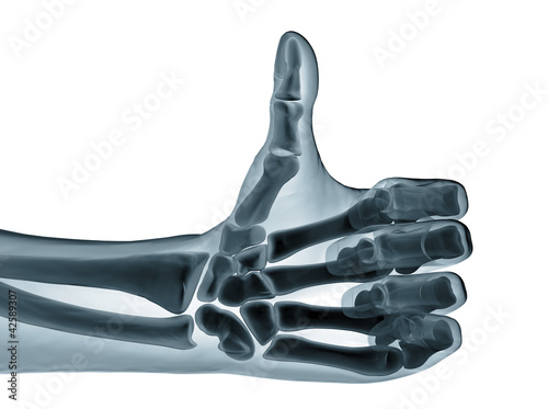 Illustration: hand xray hand xray