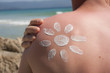 Sonnenbrand