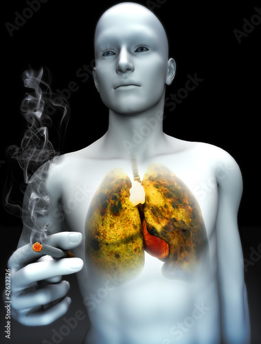 Illustration: Smoking kills concept ,Male smoking with view of rotting lungs Smoking kills concept ,Male smoking with view of rotting lungs