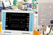 cardiogram with ECMO and intra-aortic balloon counterpulsation i