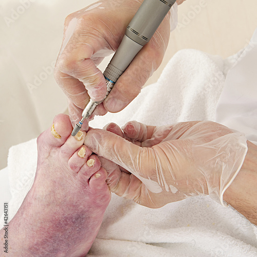 Photo: PÉDICURE - Personne Âgée PÉDICURE - Personne Âgée